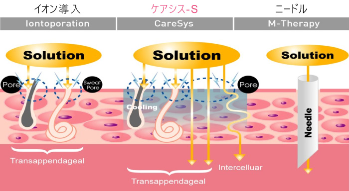 Caresys-s - Nagoya Atsuta Medical Clinic 日本熱田再生醫療中心